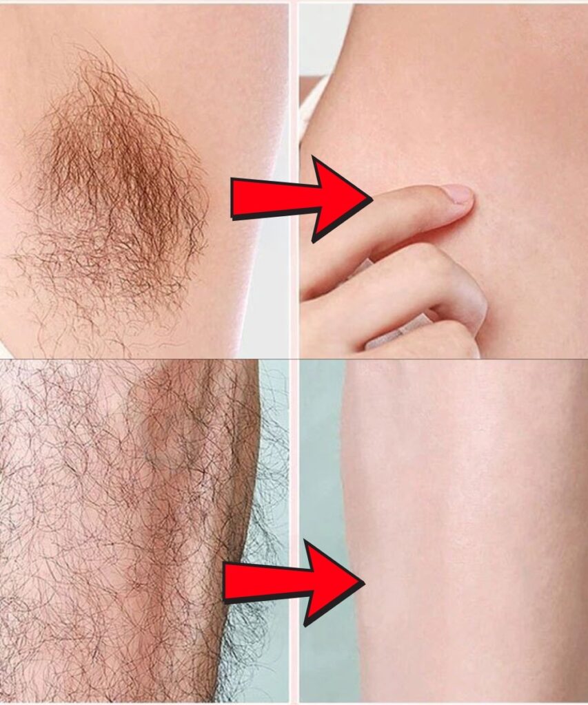 Stop Shaving! Here’s How to Get Rid of Facial, Body, and Pubic Hair with Natural Ingredients