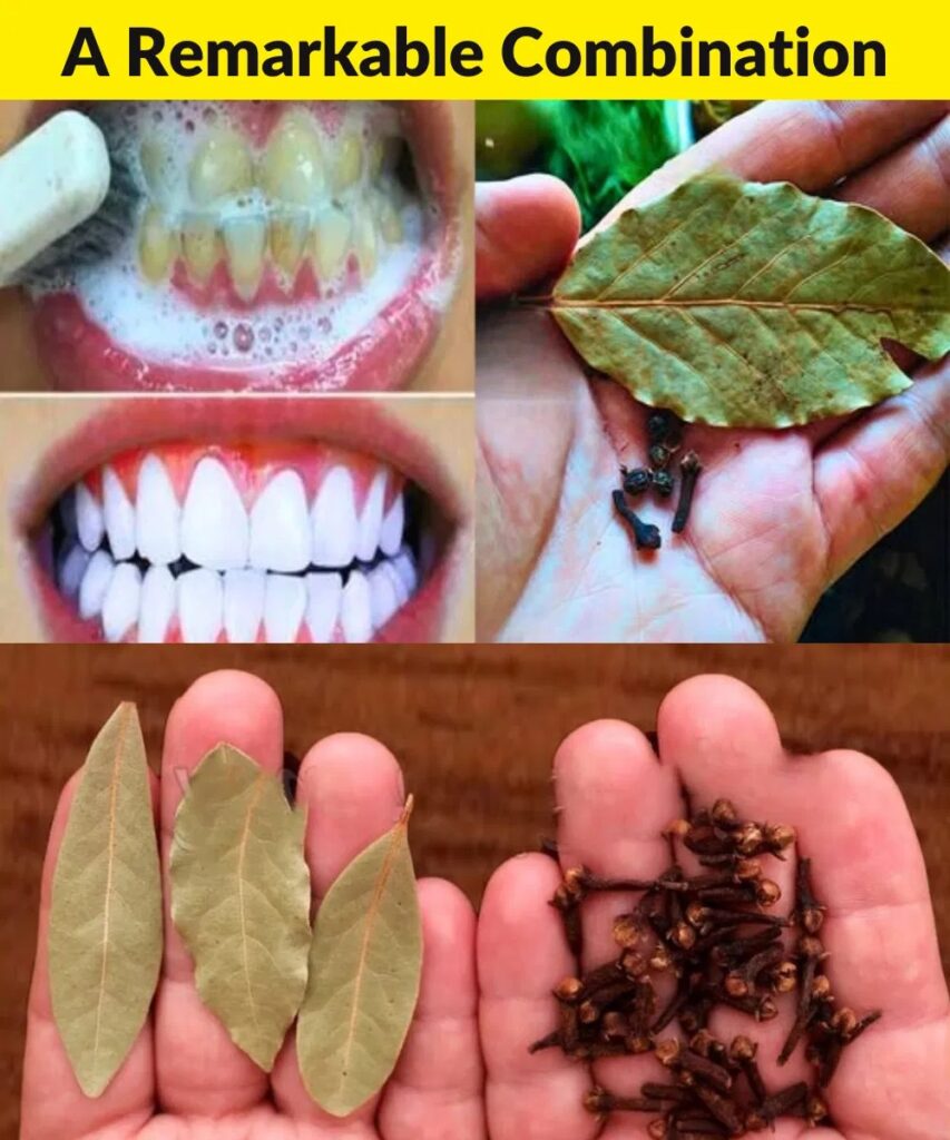 How to whiten your teeth with cloves and bay leaves?