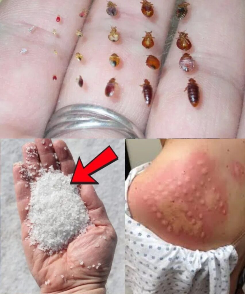 How to Use Salt to Eliminate Bedbugs from Your Garden — Naturally and Effectively