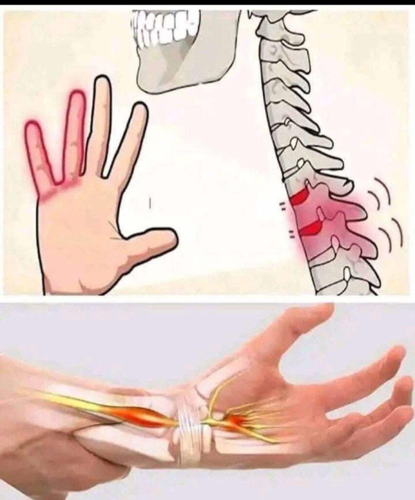 Numbness or tingling sensations in your hands!!!