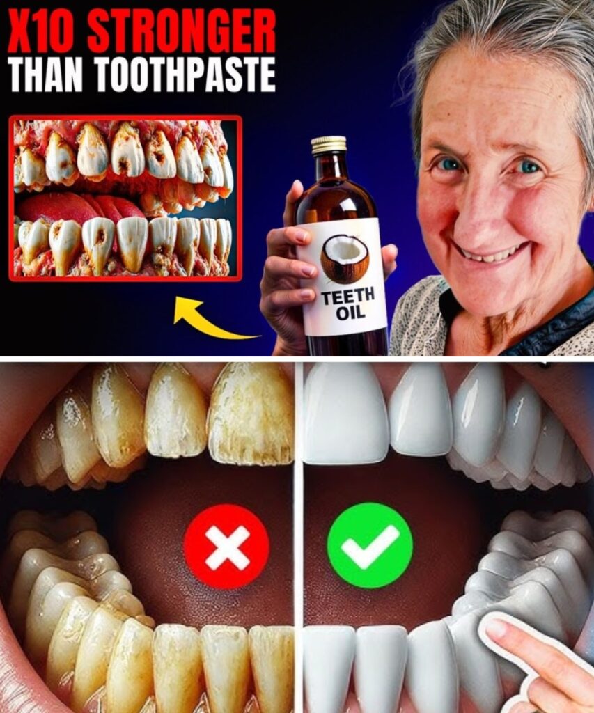 Secret to Reversing Cavities in Just 24 Hours with This Simple Oil Trick!