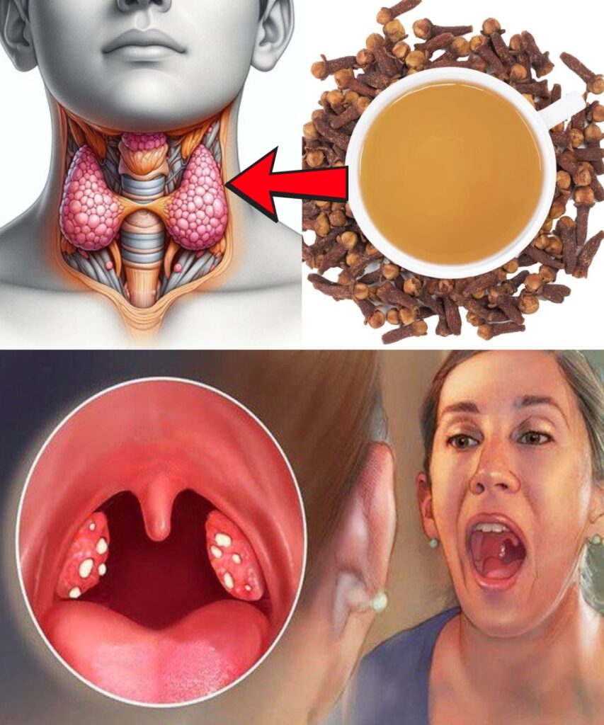 Cloves for Sore Throat Relief: A Natural Way to Soothe Inflammation and Support Healing