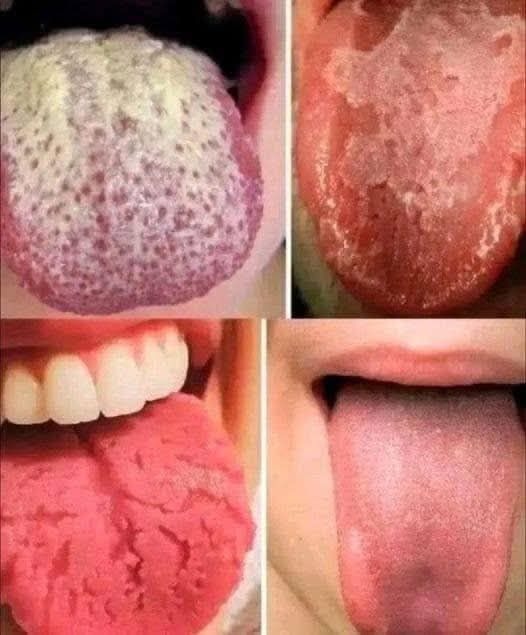 This is what your tongue says about you