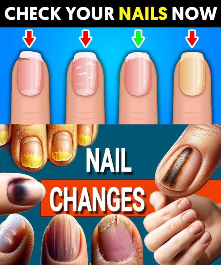 9 Things Your Nails Can Tell You About Your Health