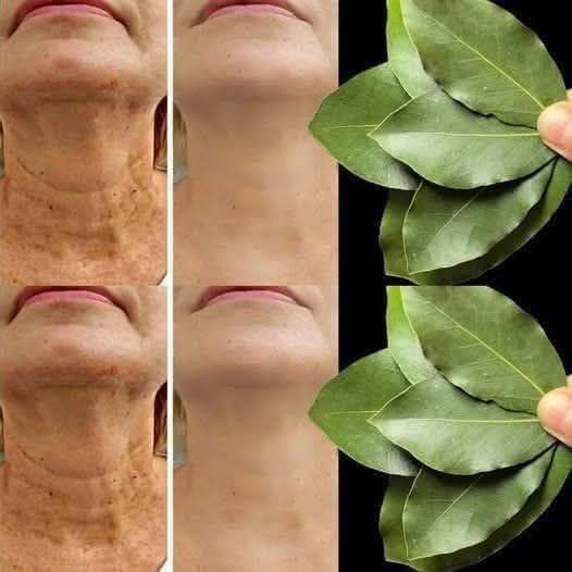 Bay Leaf The Natural Wrinkle Eraser for Ageless Beauty