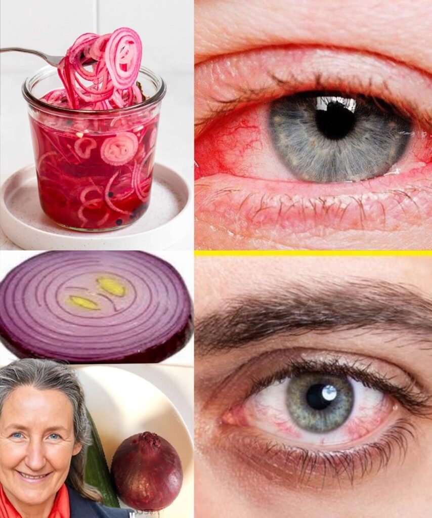 Can Onion Juice Really Help Your Vision? Here’s the Truth (And a Safe Way to Try It)