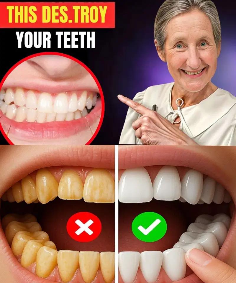 STOP DES.TROYING YOUR TEETH! The Hidden Tooth K!ller!