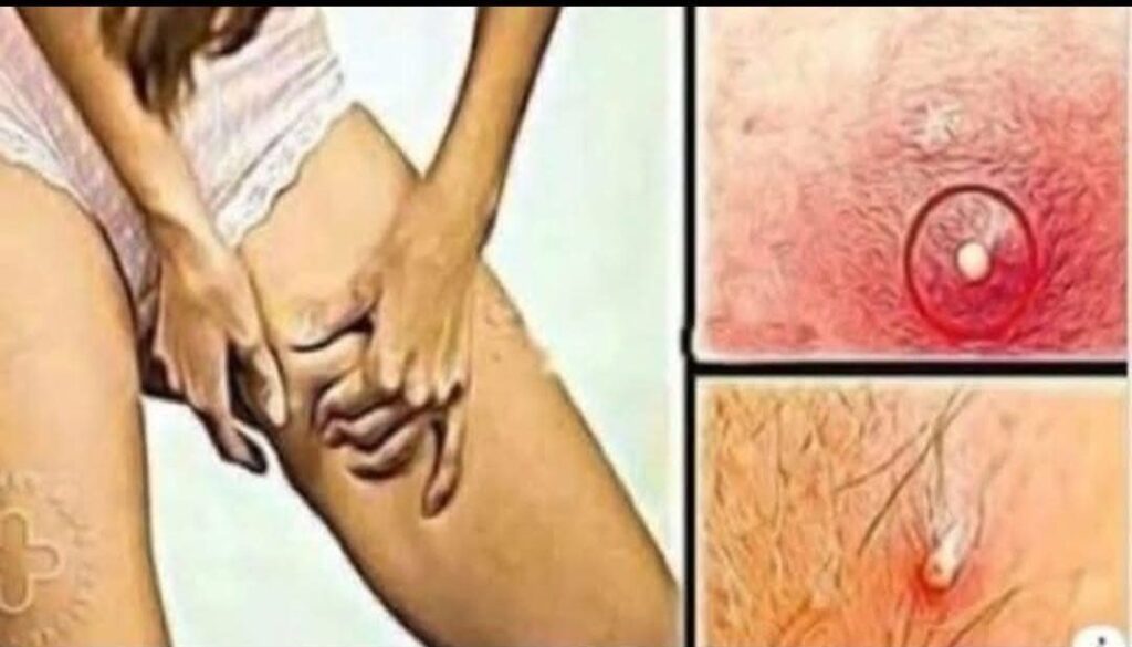  BE CAREFUL, If you spot these dots on your skin, it means you have Ca…see more