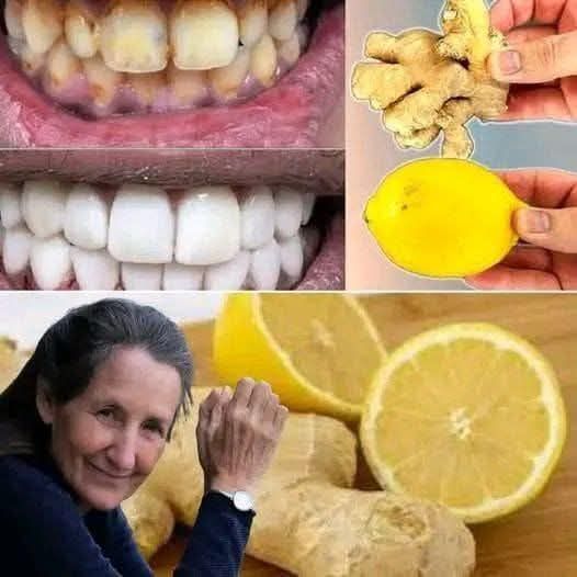 Quick Teeth Whitening with Banana Peels: Transform Yellow Teeth to Shiny White in Just 2 Minutes!