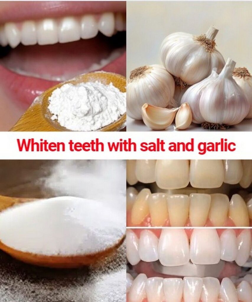 How to whiten teeth with salt and garlic?