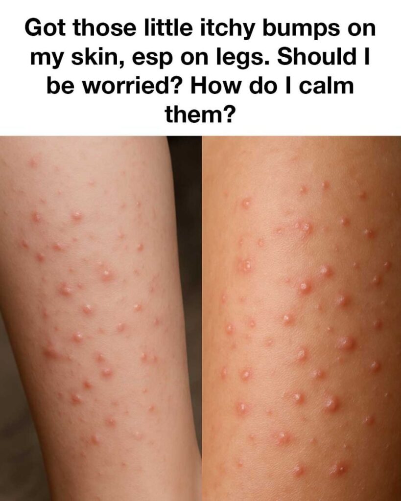 Got those little itchy bumps on my skin, esp on legs. Should I be worried?