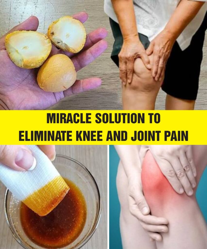Miracle solution to eliminate KNEE and JOINT PAIN