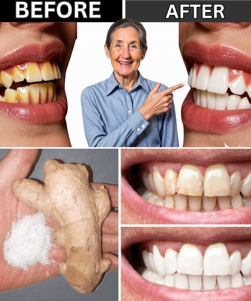 Say Goodbye to Dental Plaque Forever—Dentists Are Hiding It!