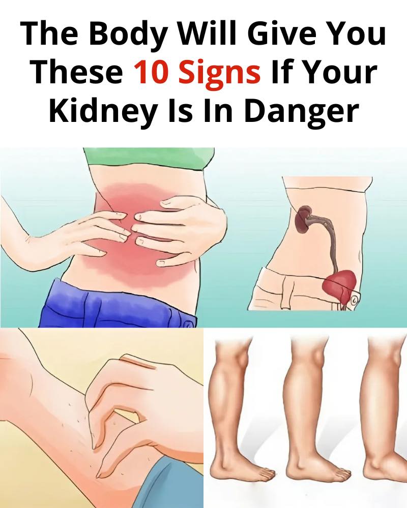 10 Symptoms of Kidney Disease