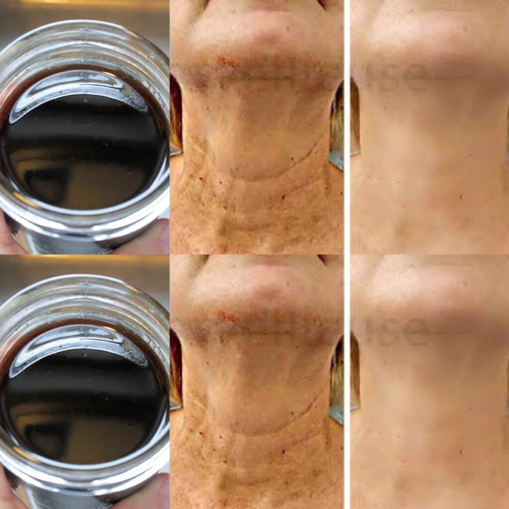 The Natural Anti-Aging Power of Coffee Oi