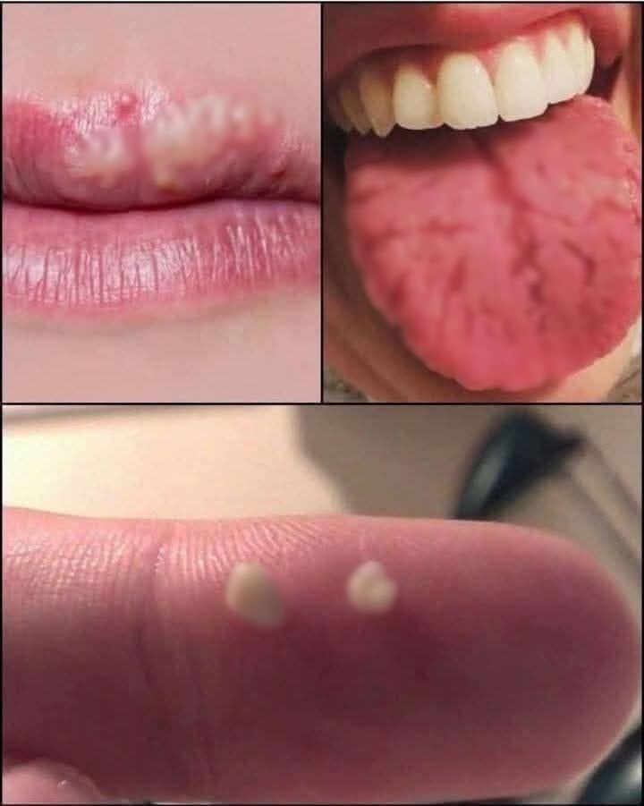If You Notice These Strange Bumps on Your Body, It Could Be a Sign of Something Serious!
