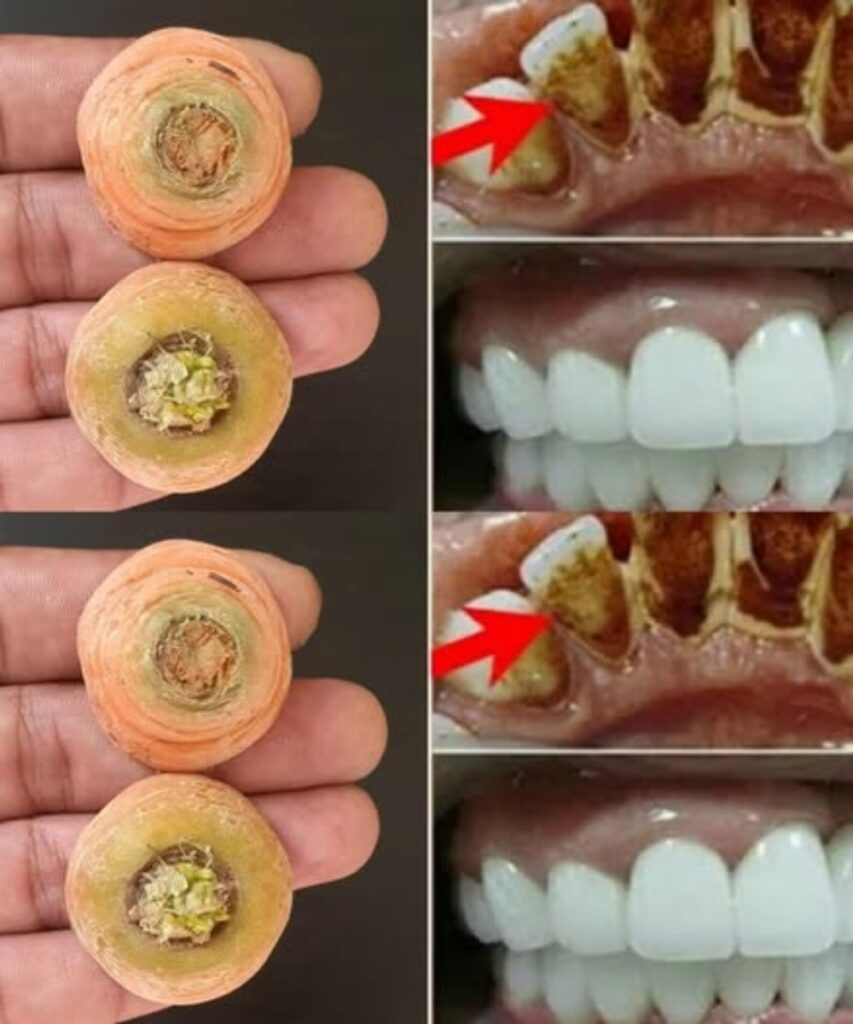 Brighten Your Smile Naturally with Carrot Ends: A Simple Home Remedy for Teeth Whitening