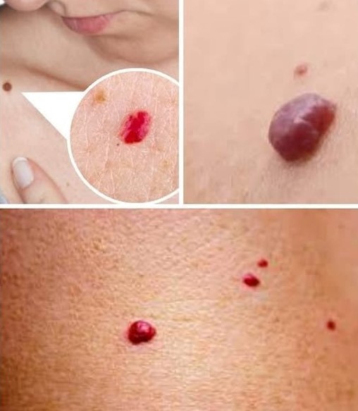 If You Notice These Red Dots On Your Skin, Here’s What They Mean