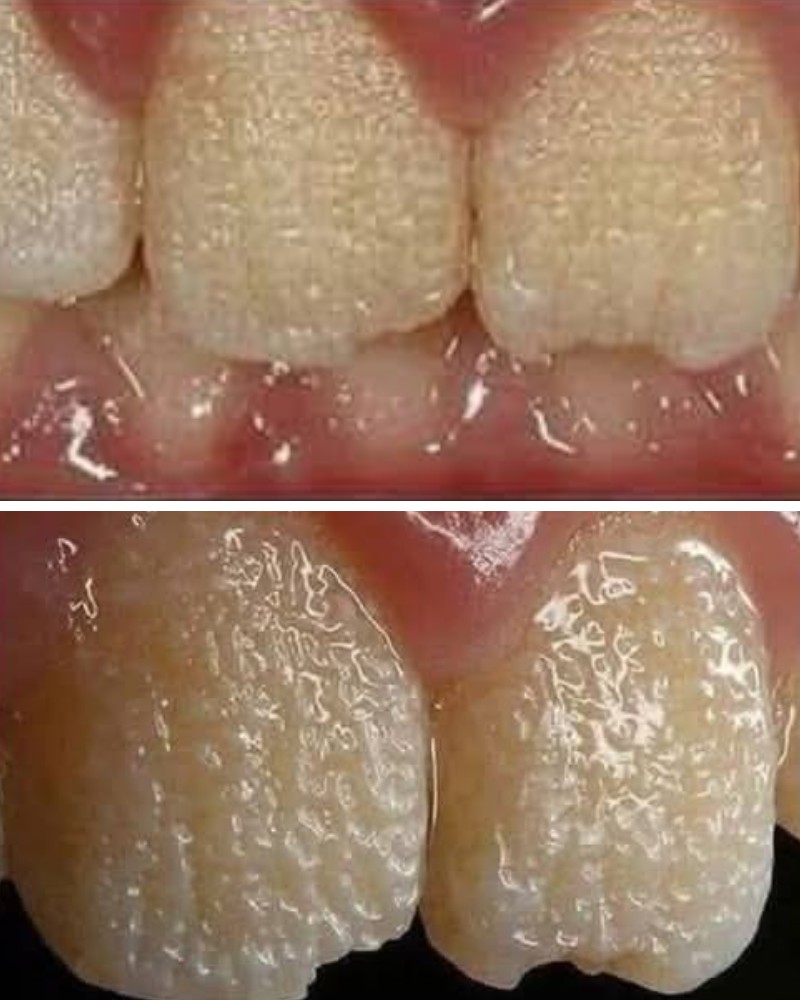 Be careful!! This is what your teeth will become when you eat…