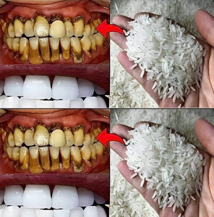 It’s Better Than Dentures: My Boss Is A Dentist And He Taught Me This