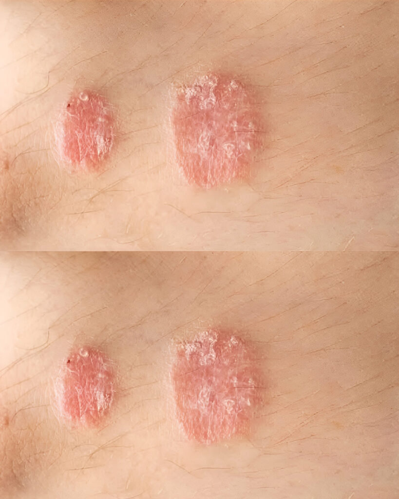 Warning Signs You Should Never Ignore About Your Skin