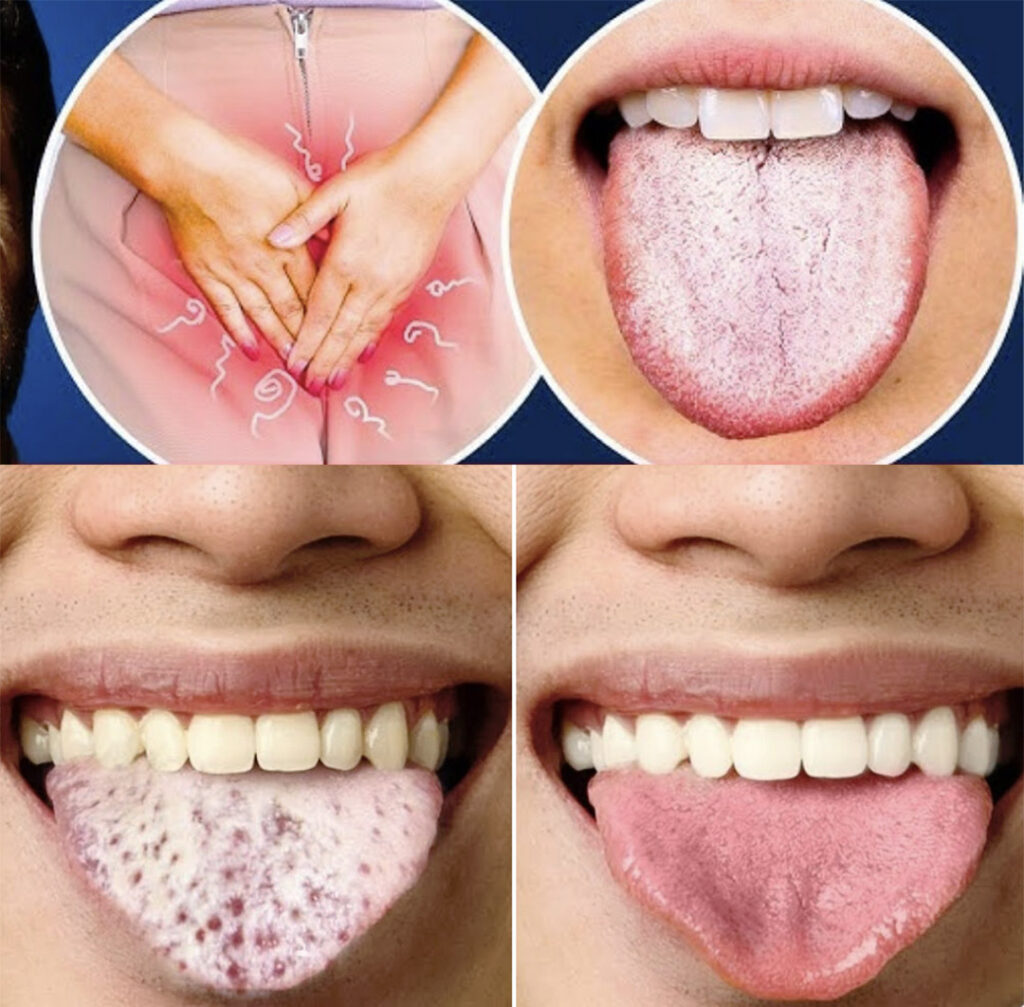 White Tongue, Constant Fatigue, Sleep Issues, Bloating… What Are They Really Symptoms Of?