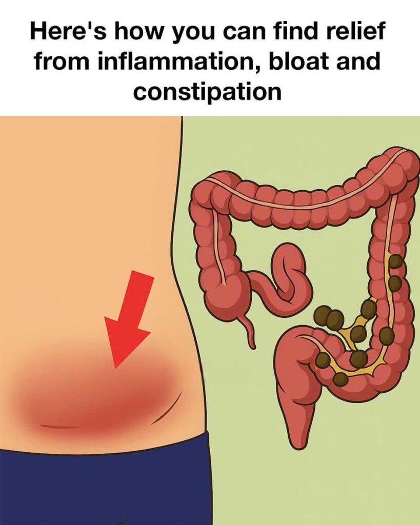 Here’s how you can find relief from inflammation, bloat and constipation