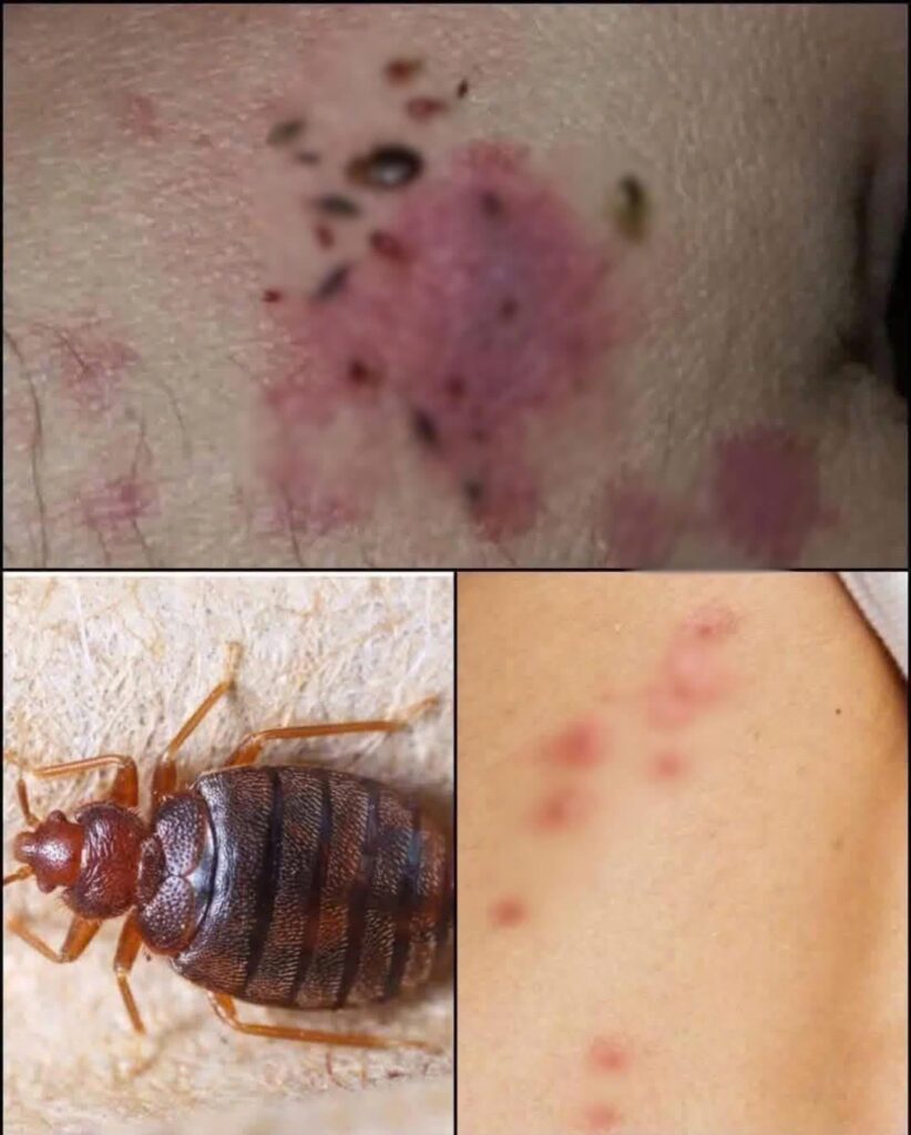 If you spot these dots on your skin, BE CAREFUL