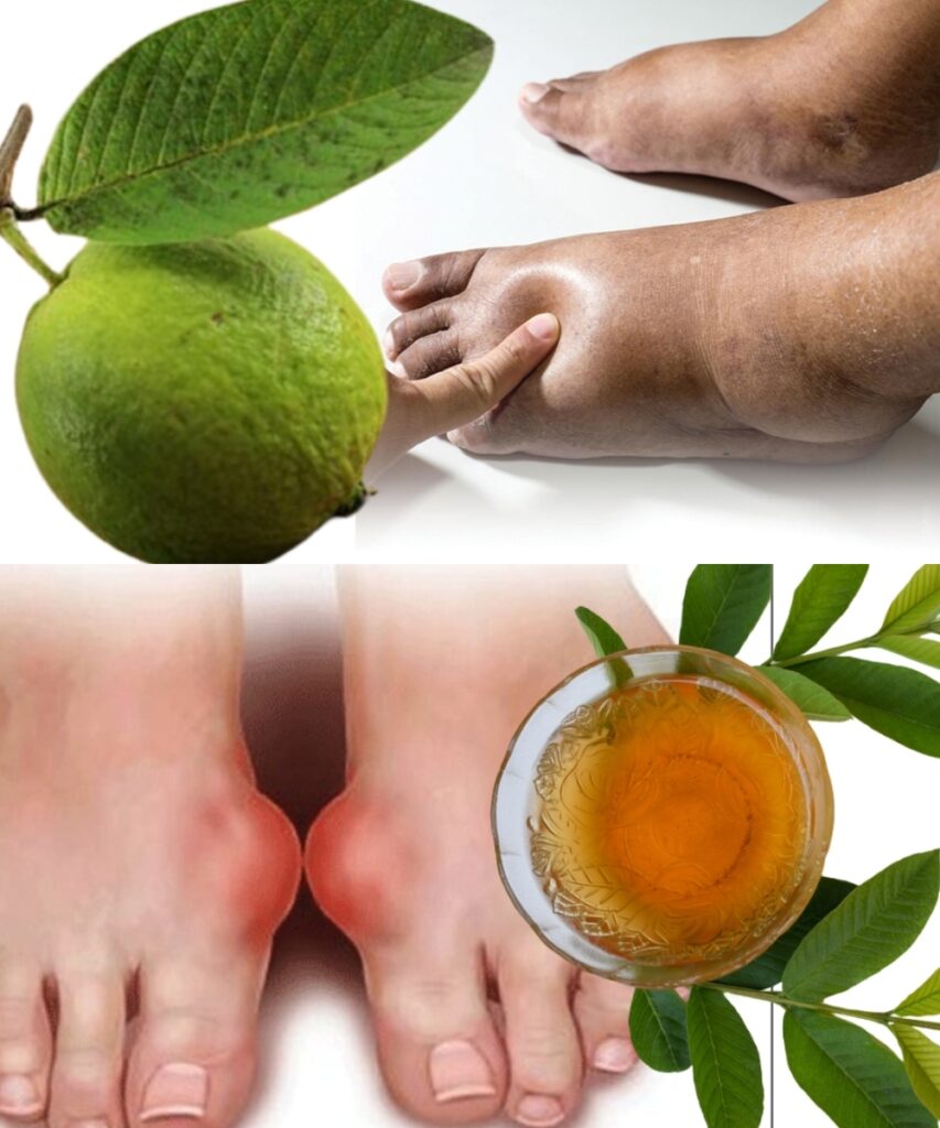 Guava Leaves for Water Retention: A Natural Remedy That Actually Works