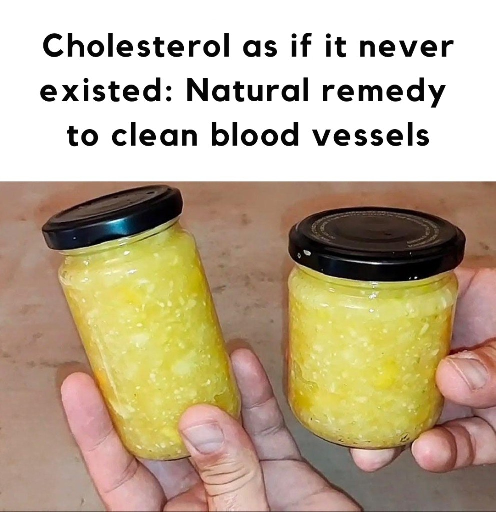 Cholesterol as if it never existed: Natural remedy to clean blood vessels
