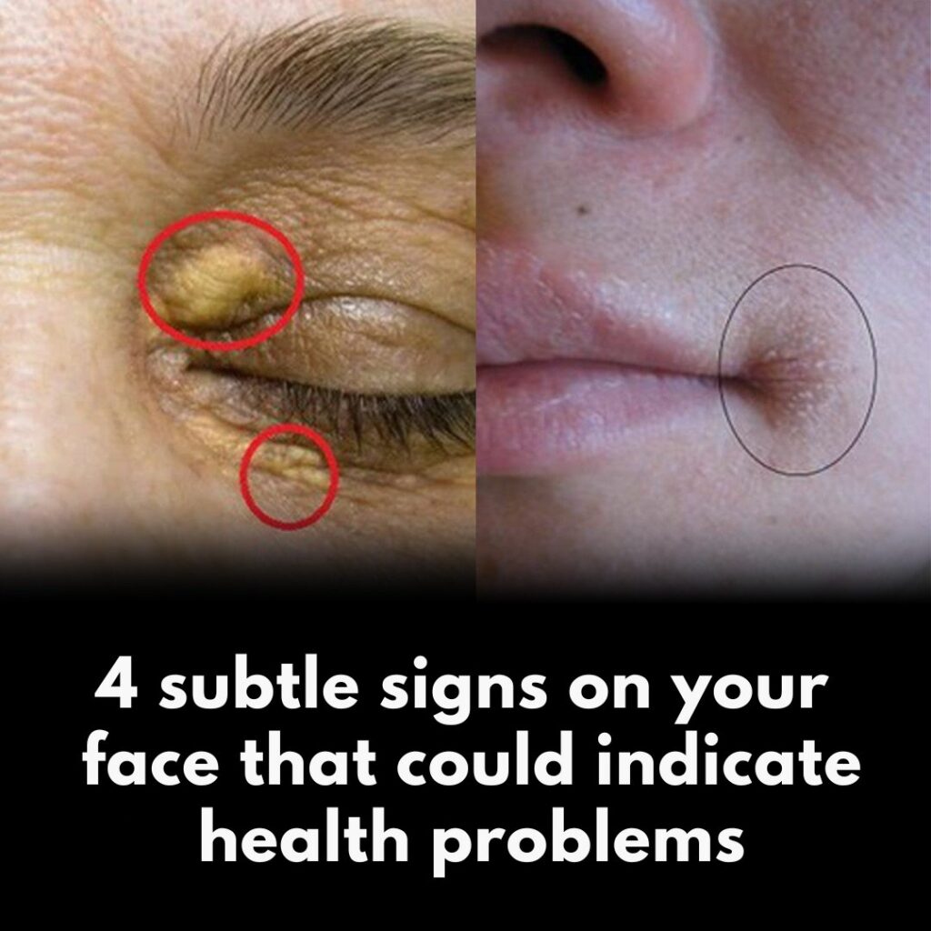 4 subtle signs on your face that could reveal health problems