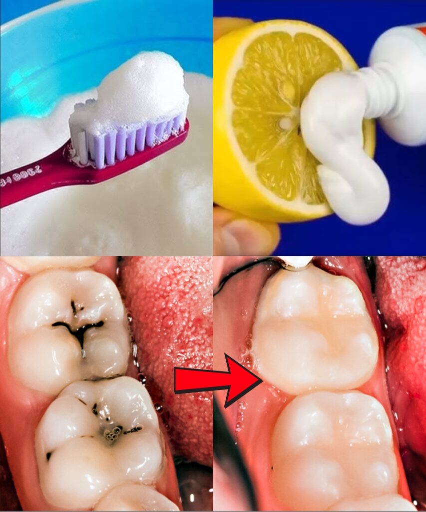 Natural Ways to Help Prevent Cavities and Strengthen Your Teeth