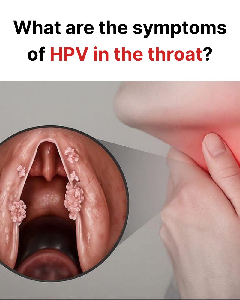 What are the symptoms of HPV in the throat?