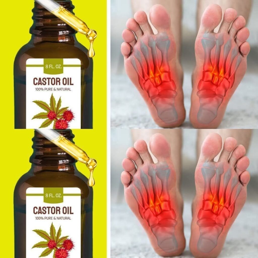 The Remarkable Effects of Castor Oil When Used Before Bed