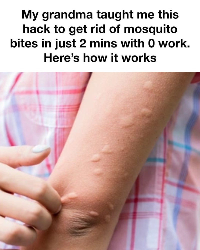 My grandma taught me this hack to get rid of mosquito bites in just 2 mins with 0 work. Here’s how it works