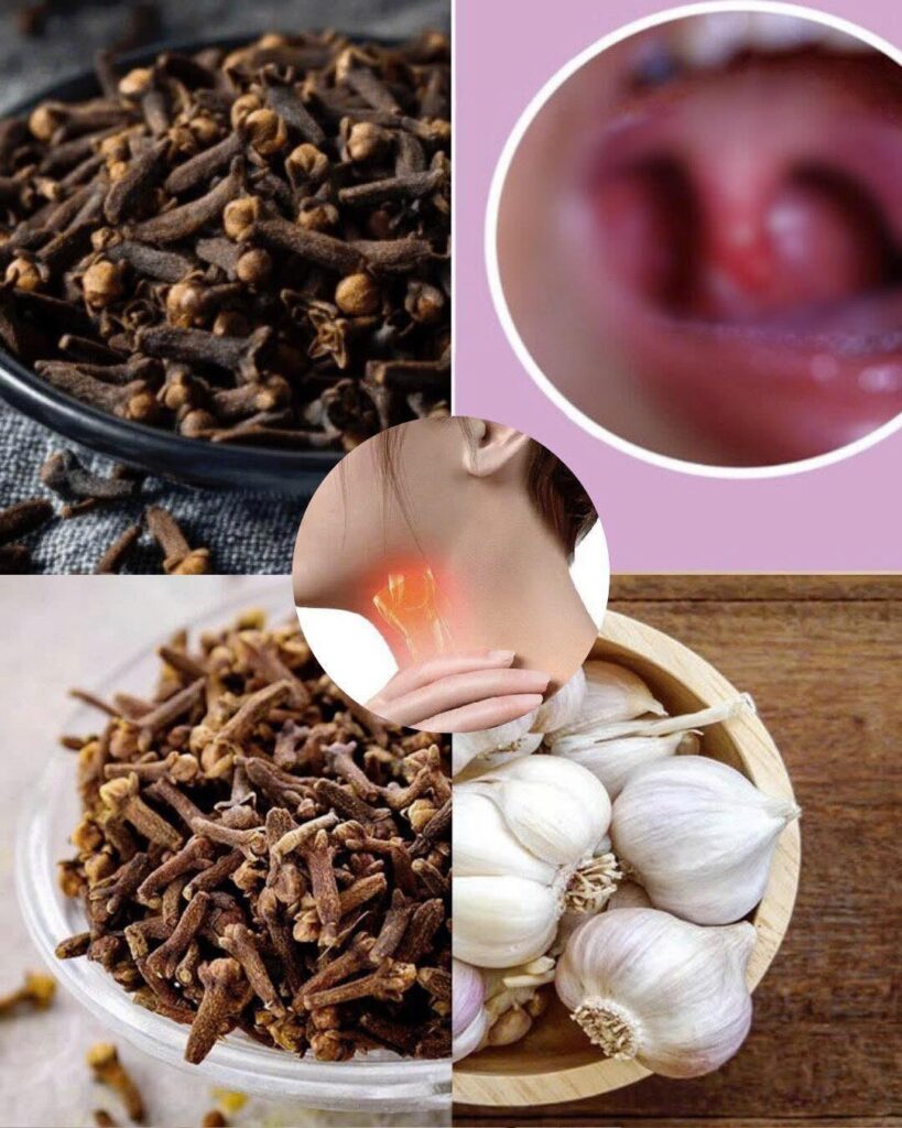 Cloves for Sore Throat Relief: A Natural Way to Soothe Inflammation and Promote Healing