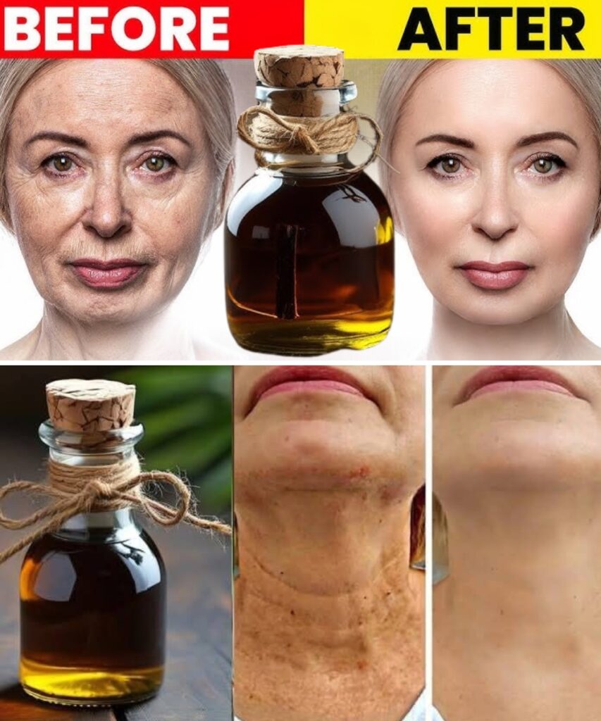 Anti-Aging Magic Oil: Coffee Oil That Erases Wrinkles and Is Stronger than Botox!