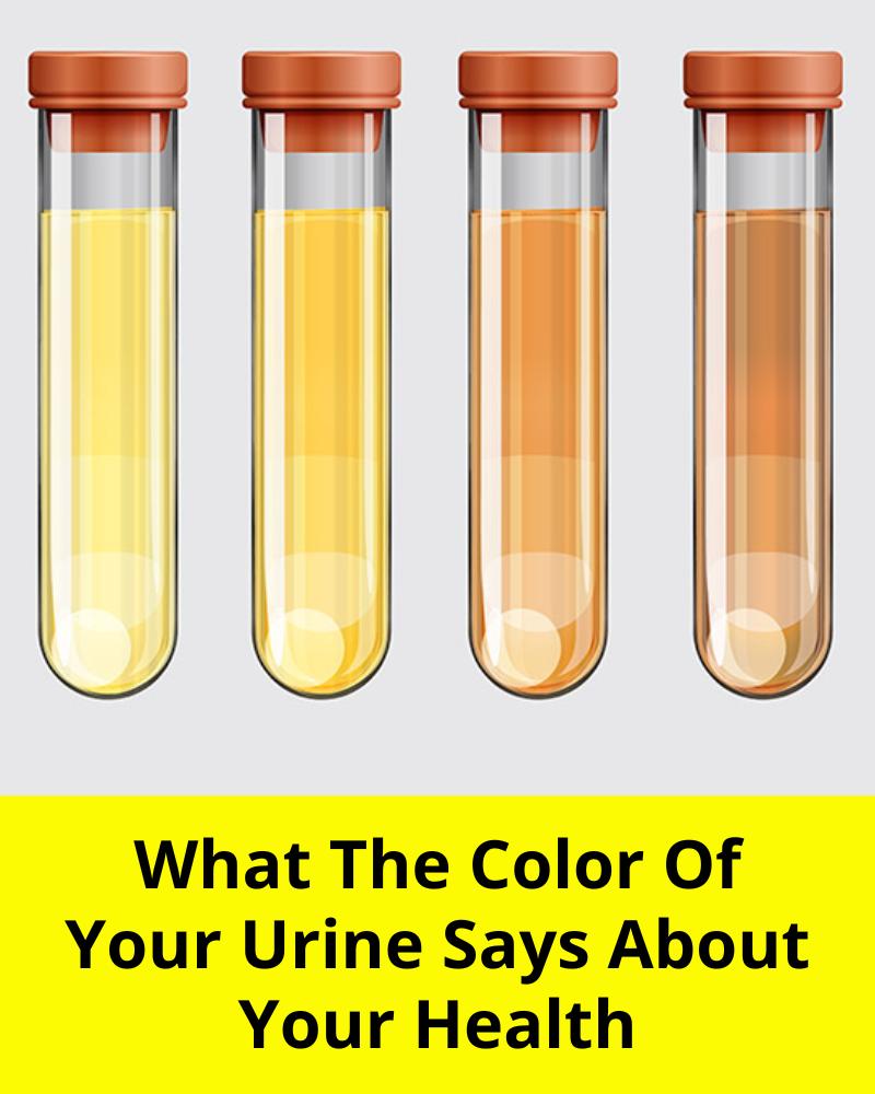 What The Color Of Your Urine Says About Your Healts