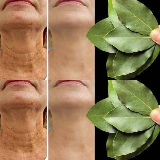 Bay Leaf Is 100,000 Times Stronger Than Botox? | Natural Wrinkle Eraser Even at Age 70!
