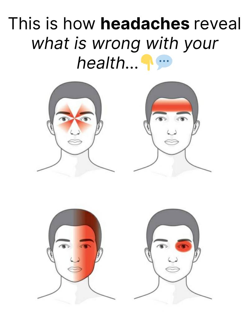 This is How Headaches Reveal What is Wrong With Your Health