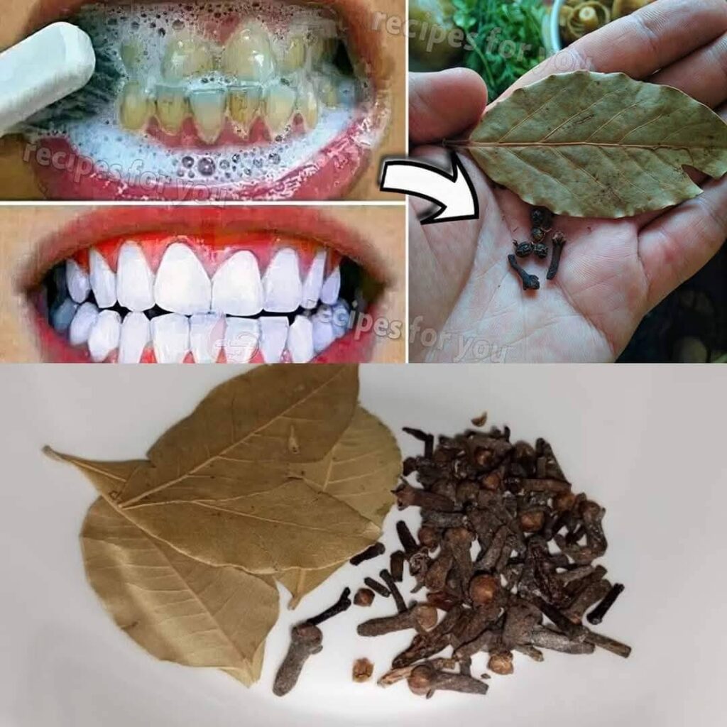 The Secret to Natural Teeth Whitening: Cloves and Bay Leaves