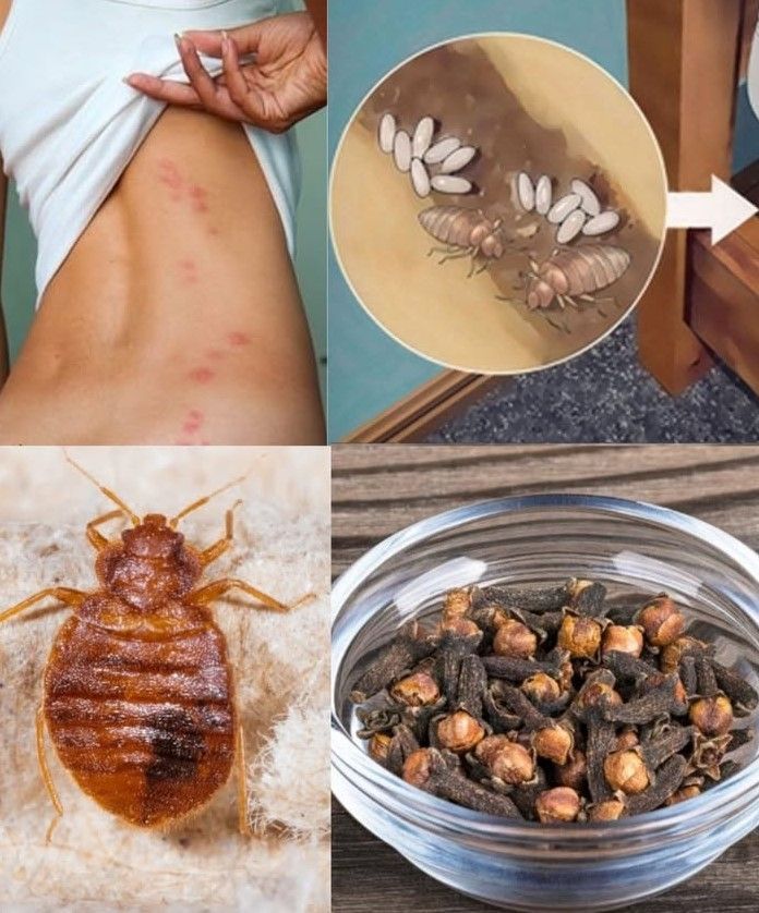 Bedbugs Beware: How to Naturally Repel Them with Clove Oil