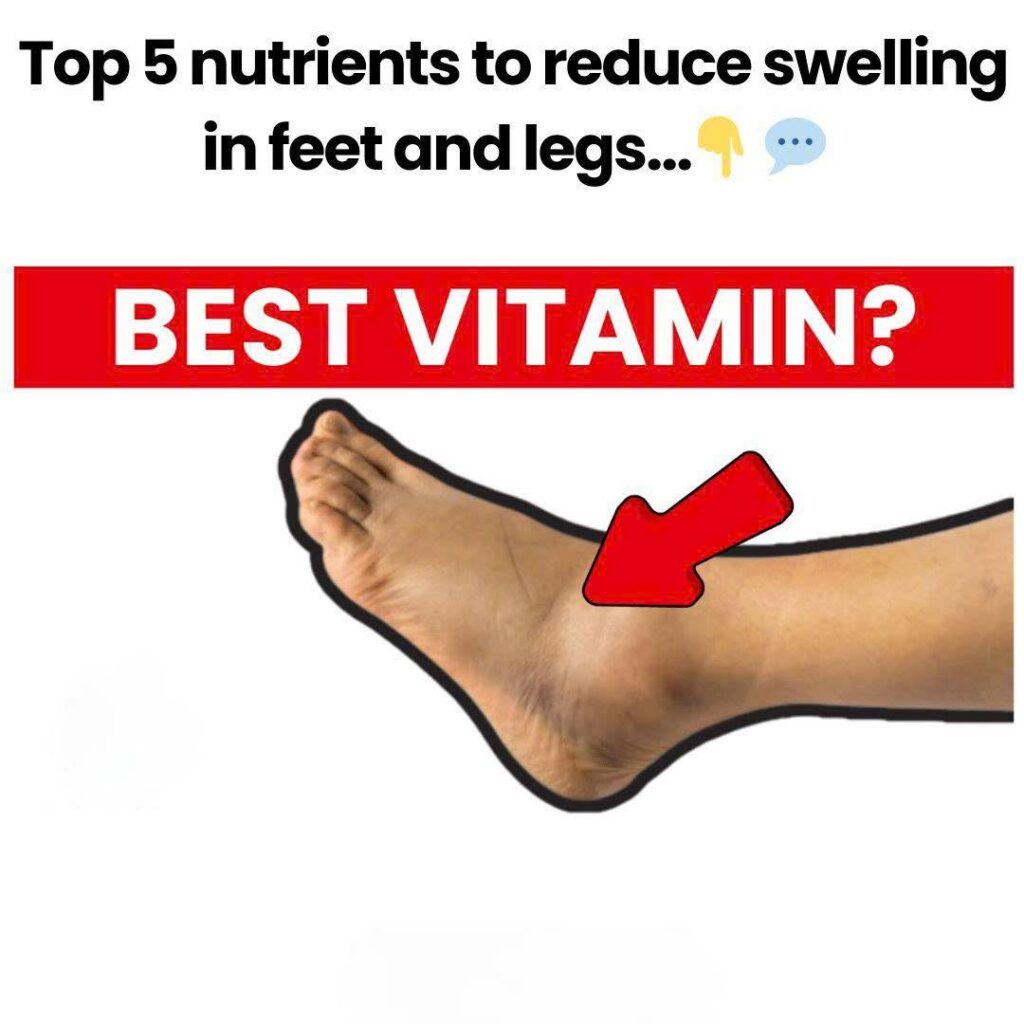 Top 5 Nutrients to Reduce Swelling in Feet and Legs