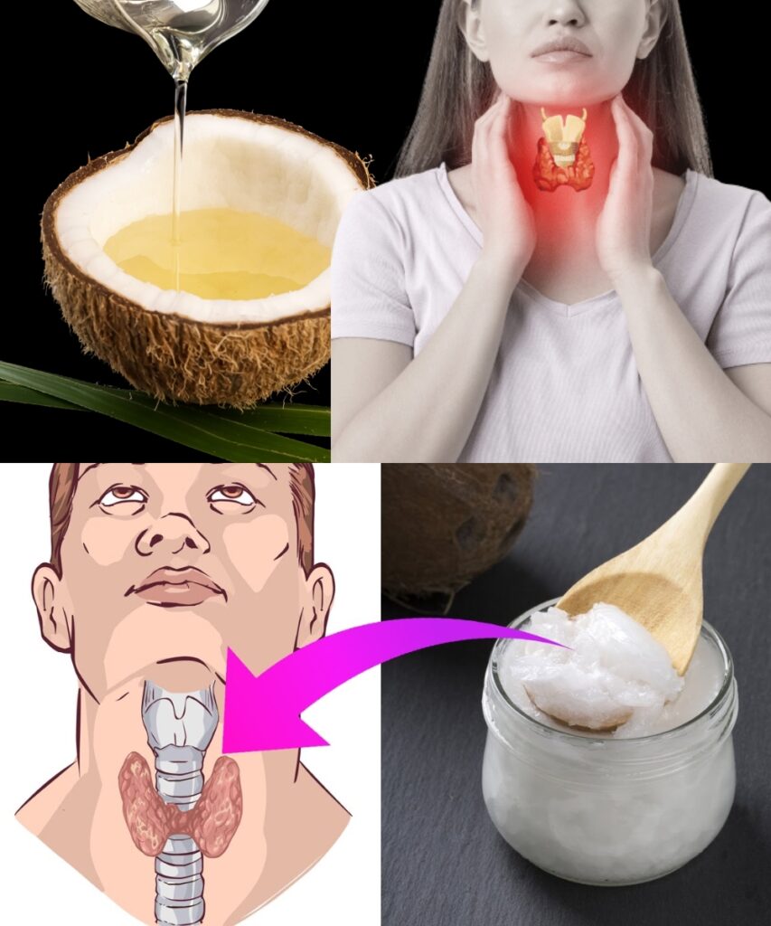 6 Ways Coconut Oil Can Benefit Those With Thyroid Problems