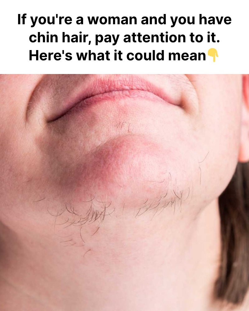 What Chin Whiskers Might Tell You About Your Health