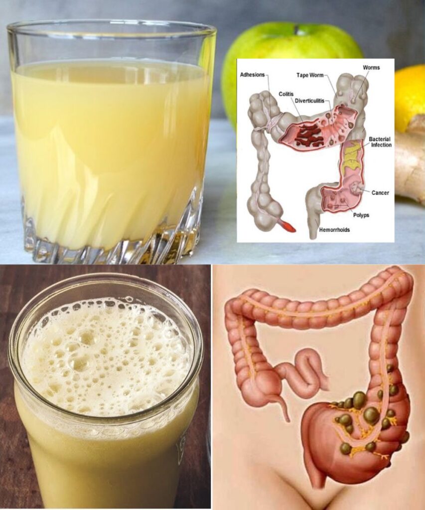 How to Clean Your Colon and Remove Waste Naturally