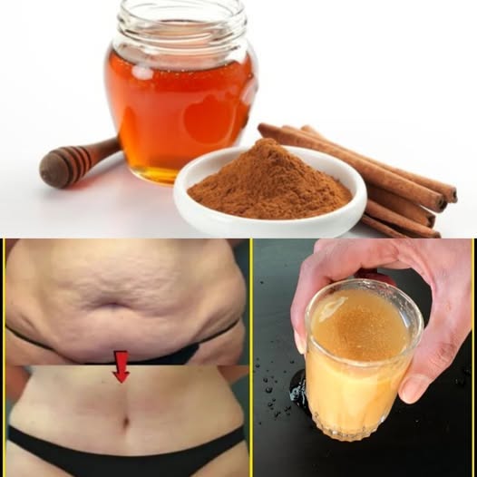 In the Morning, Eat These Two Things Together and the Belly Fat Will Be Gone! No Exercise, No Diet – Honey and Cinnamon 