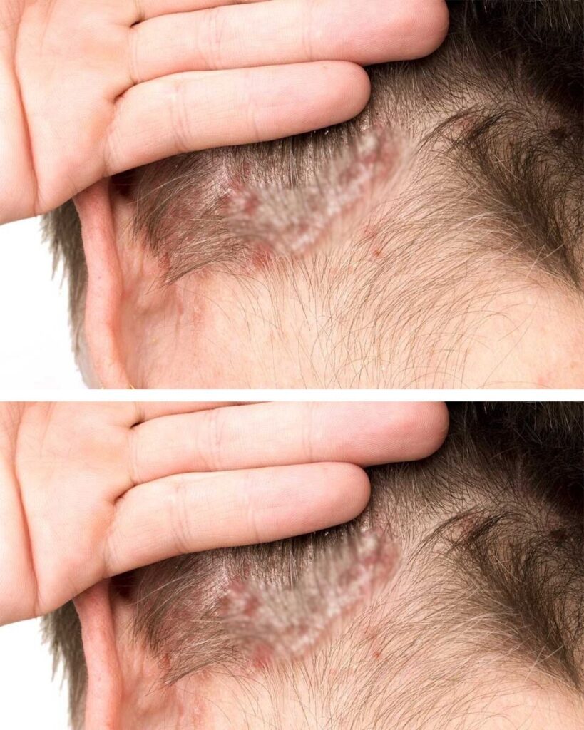 Found this on my son’s scalp. Have no idea what it is and we can’t get a doc appt soon