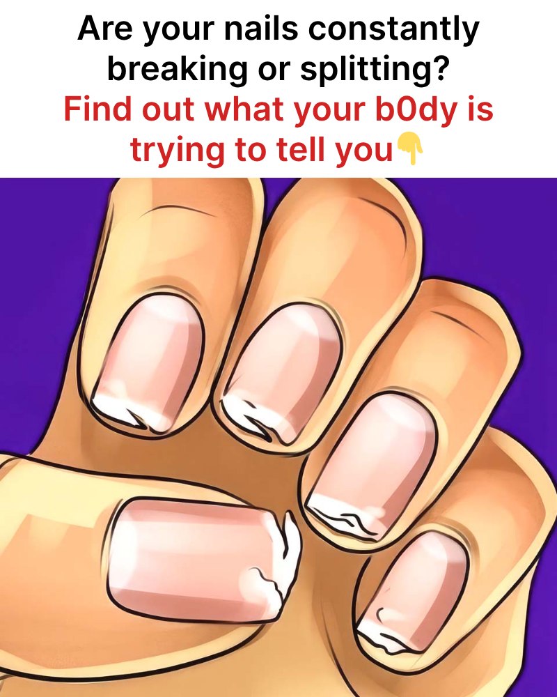 Are your nails constantly cracking or splitting? This is the message your body is trying to send you.