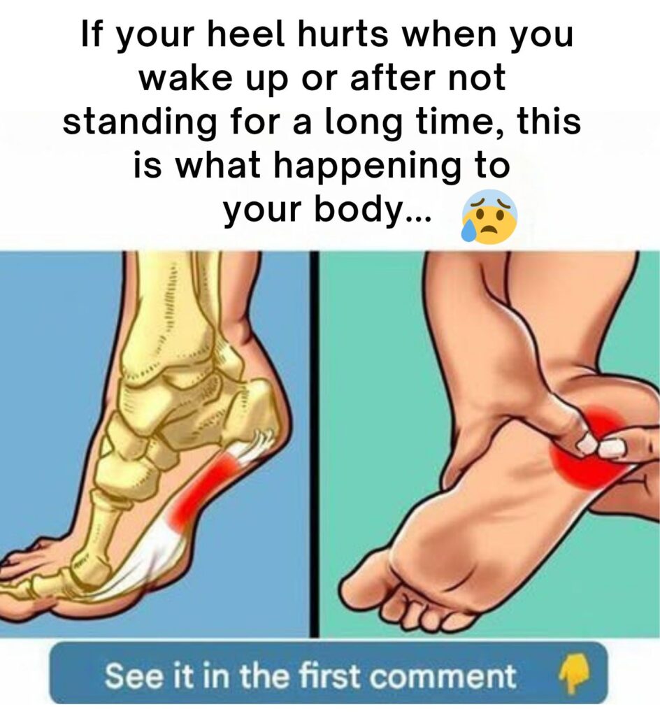 Recommended Exercises to Treat Plantar Fasciitis